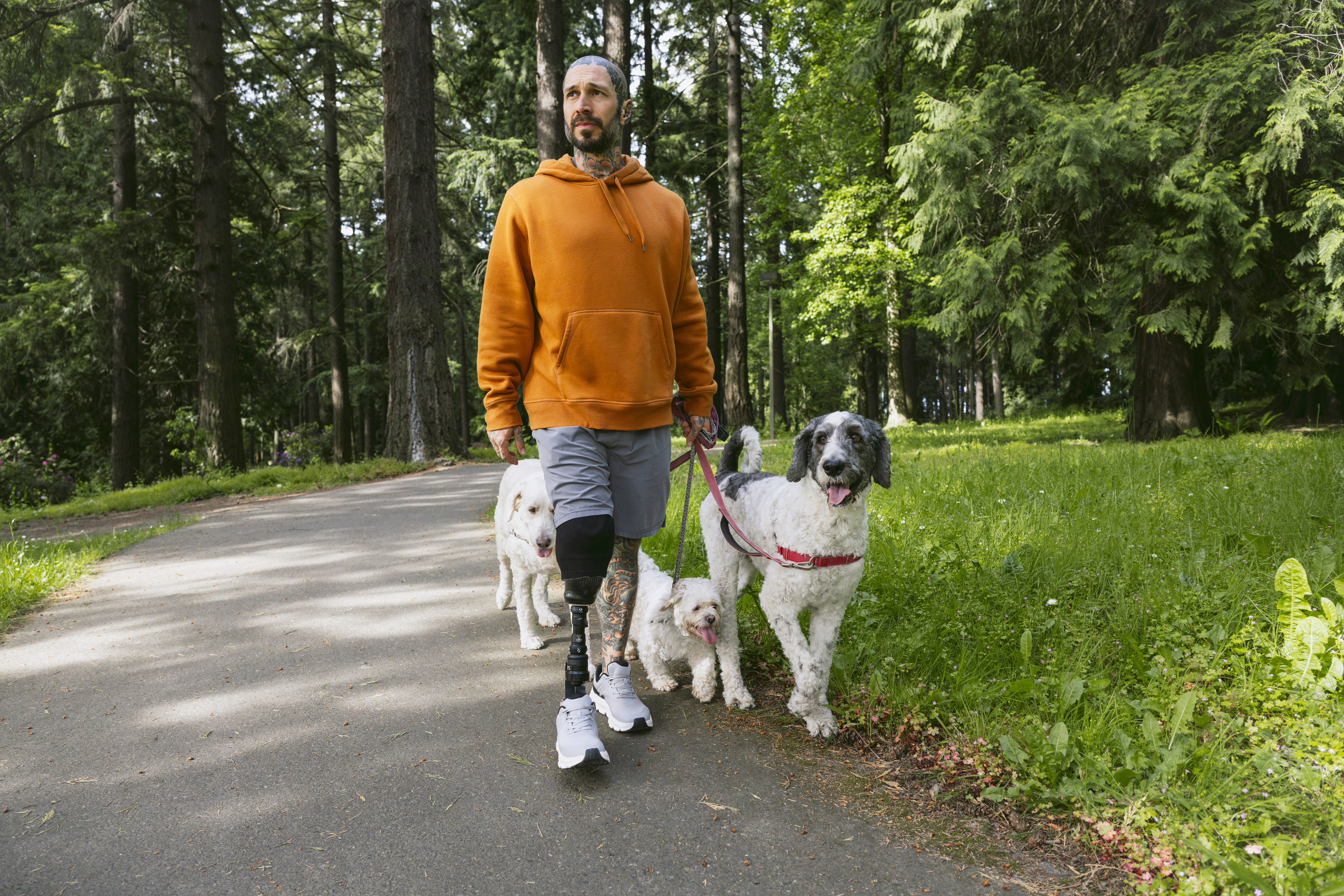 Man with prosthetic leg walking dogs at park.